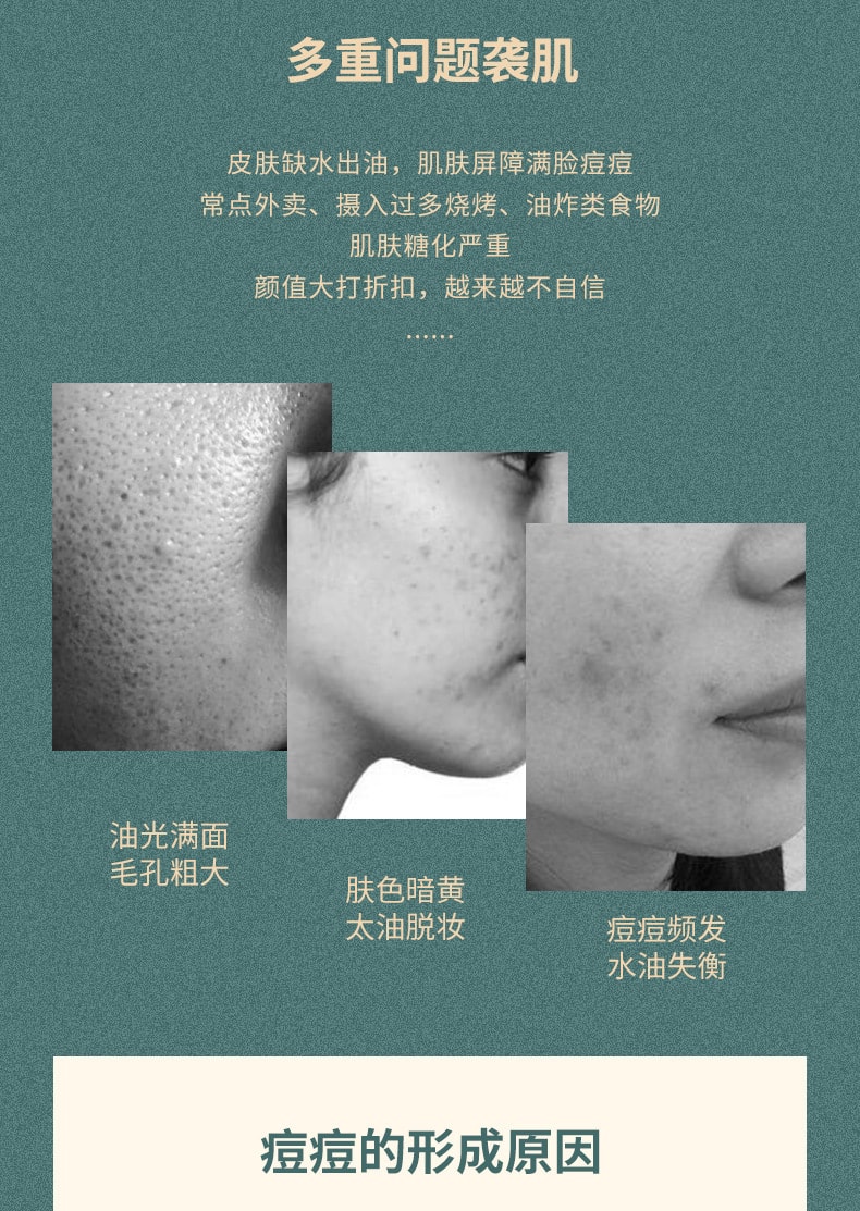 【中国直邮】白云山 净颜修护淡化青春痘去痘膏 30g