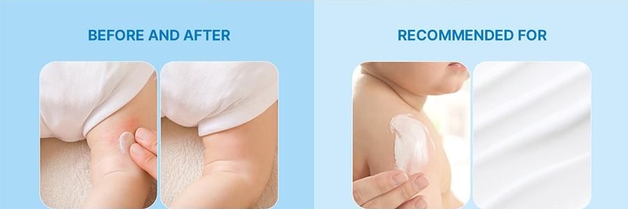 韓國BEBESUP 兒童舒緩修復霜 寶寶護膚 200毫升