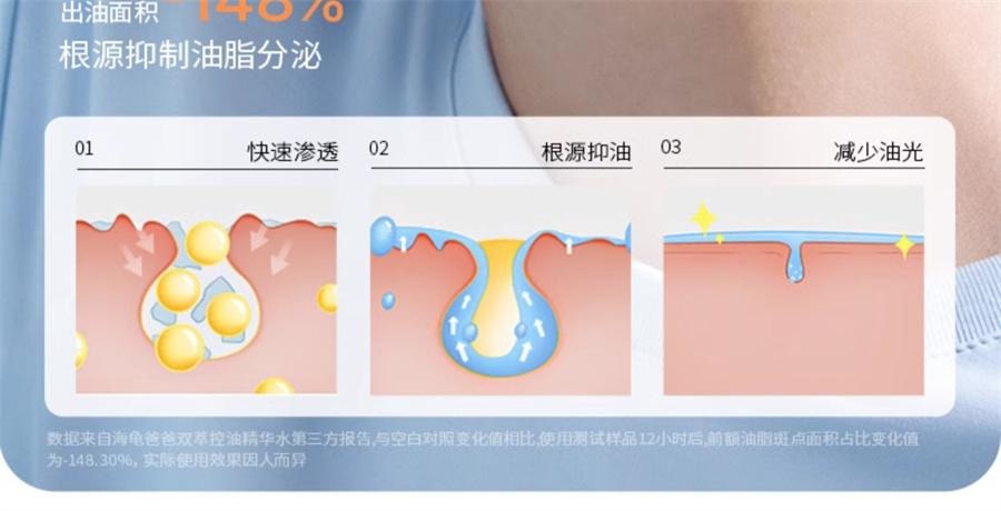 【中国直邮】 海龟爸爸 闭口水青少年控油抗痘爽肤水收缩毛孔精华水女孩湿敷水 150ml/瓶