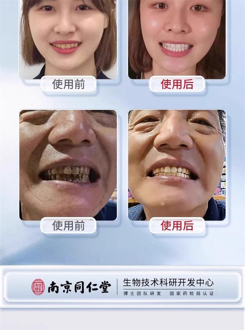 【中國直郵】 南京同仁堂 去黃牙膏煥白小蘇打去牙垢煙漬茶漬口氣清新男女通用 100g