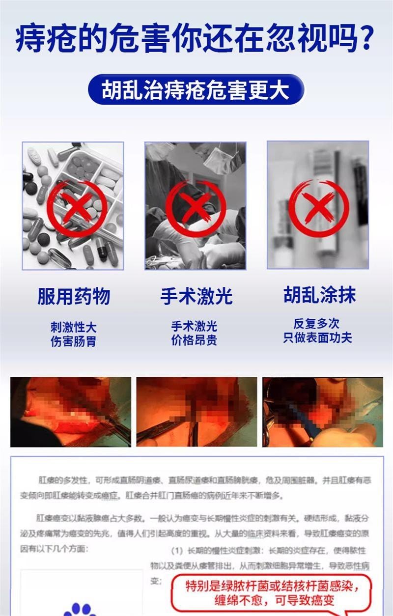 【中國直郵】 修正 卡波姆痔瘡膏醫用凝膠肛門軟膏內痔混合痔瘡專用 15g/支