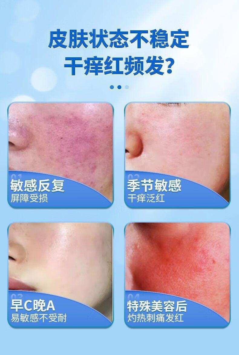 【中国直邮】修正 胸腺肽皮肤屏障修护舒缓保湿霜 红血丝修护角质层敏感肌脸部 35g/支