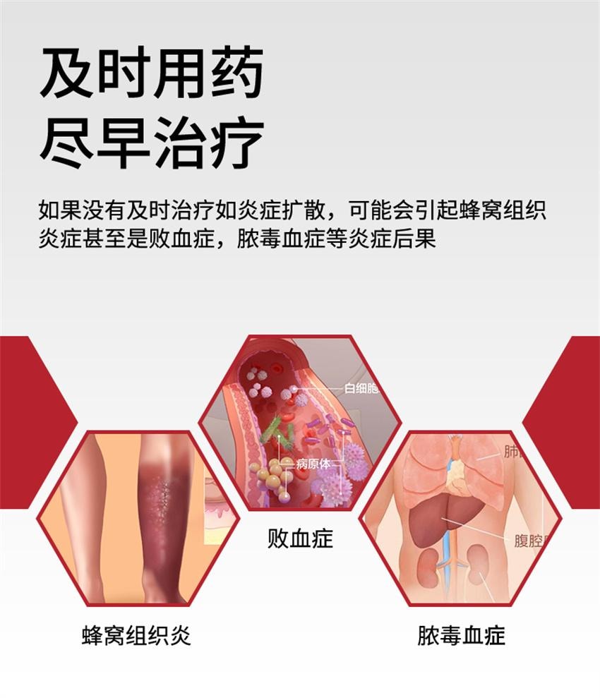 【中国直邮】 国药药材 鱼石脂抑菌软膏 适用于疖肿拔毒拔脓膏消肿止痛火疖子毛囊乳膏 20g/盒
