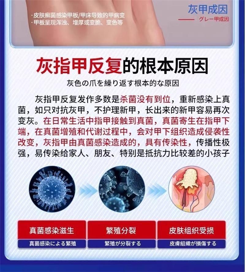 【中國直郵】 香港大藥房 鹽酸阿莫羅芬搽劑 灰指甲專用藥腳氣甲癬甲真菌病 30ml/盒(養成好甲)