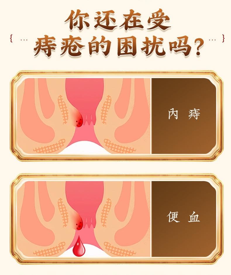 【中國直郵】 北京同仁堂 地榆槐角丸9g*10丸/盒*3盒治療肛裂痔瘡濕熱內痔便秘