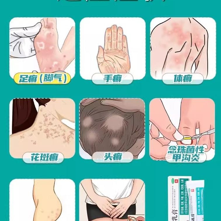 【中国直邮】 川石 克霉唑乳膏 私处止痒抑菌 适用于霉菌性阴道炎妇科10g/盒
