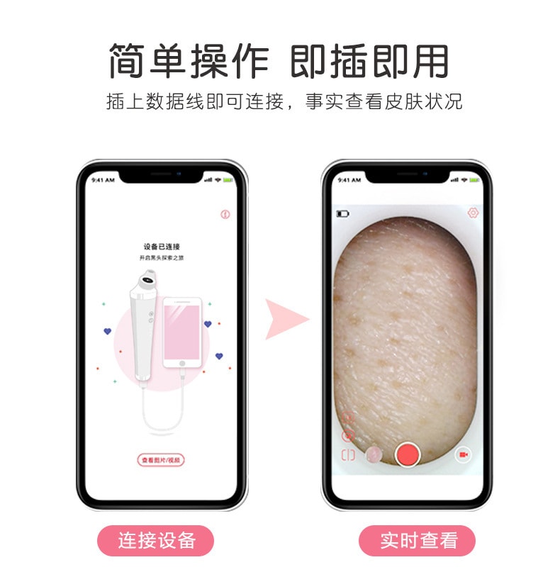 【中国直邮】北欧欧慕 可视化黑头洁面仪电动毛孔清洁器 白色款