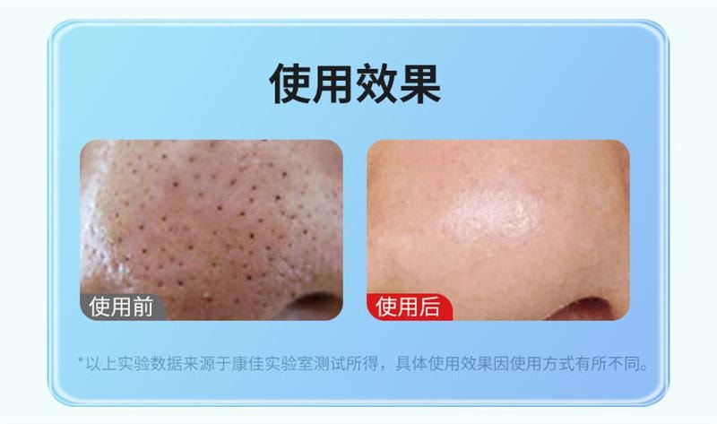 【中国直邮】 康佳 小气泡美容仪器脸部吸黑头导出仪去粉刺 挡吸力+6个吸头+1气泡水 升级白 1个