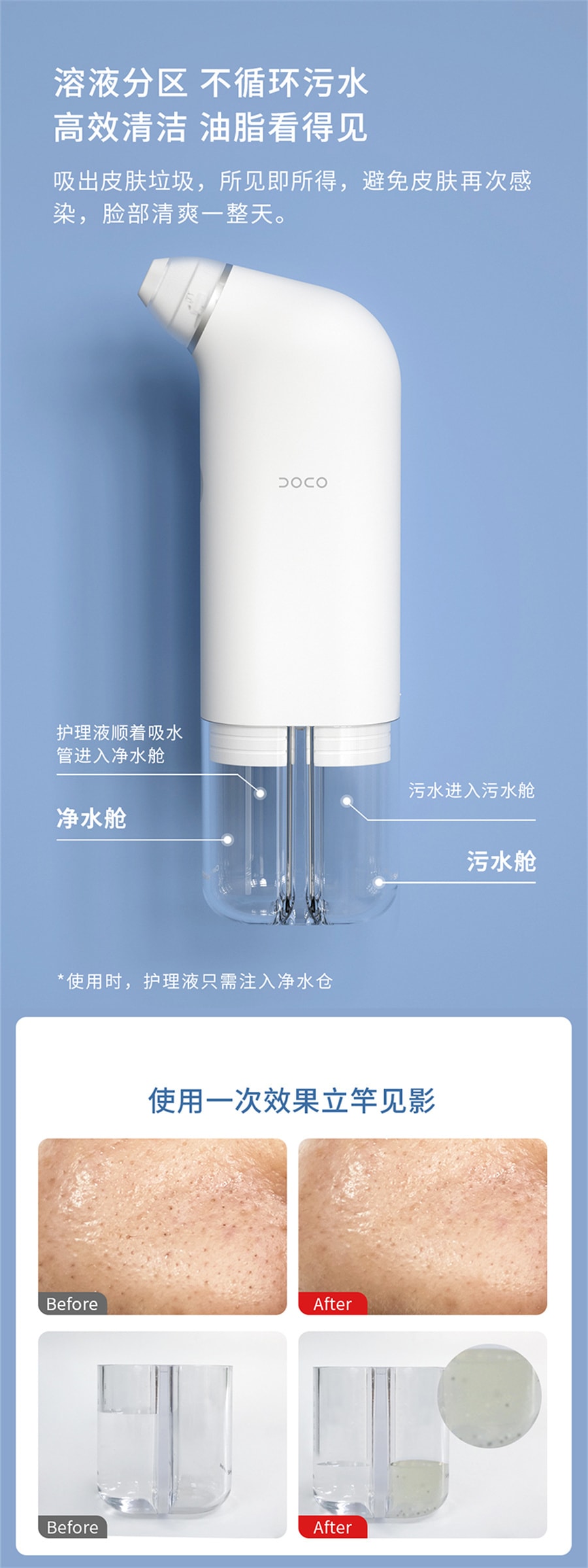 【中國直郵】DOCO小氣泡吸黑頭儀毛孔清潔神器 灰色