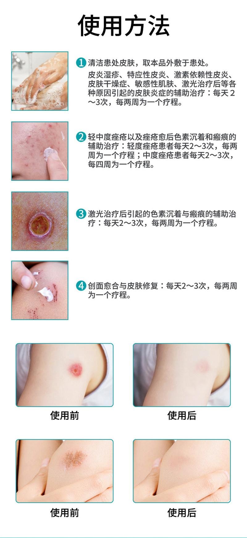 南京同仁堂 重组胶原蛋白修复凝胶 院线光子微整形术后创面护理凝胶 20g/盒