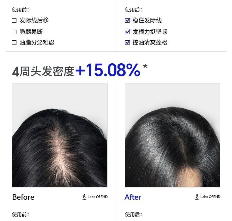 【中国直邮】 EHD 防脱防断固发洗发水 高能修护发丝 固发丰盈强韧男女士洗头膏露 300ml/瓶