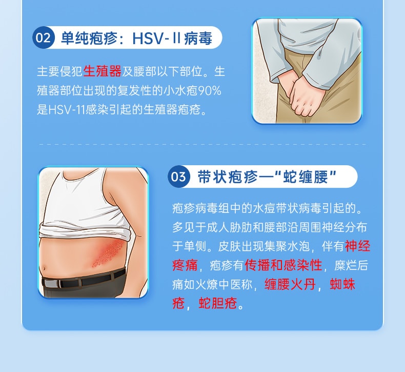【中国直邮】 恩威 阿昔洛韦软膏 正品抗病毒阿西洛韦阿希洛韦带状单纯疱疹药膏 20g/盒