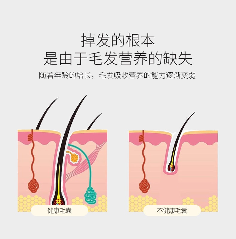中国 K SKIN 金稻 多极射频激光生发梳 头皮护理按摩仪 生发导入仪 防脱发 蓝色 1件