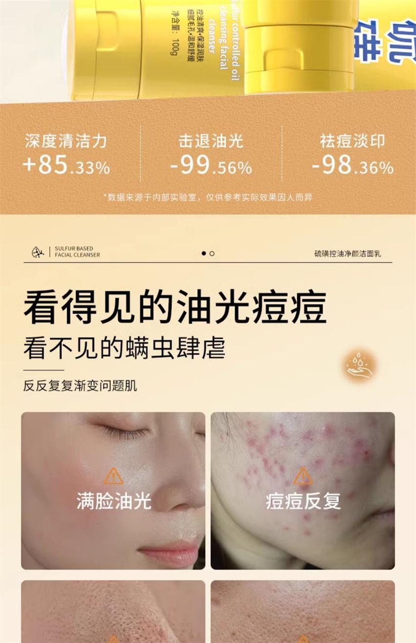 【中國直郵】傾顏 硫磺洗面乳 深層清潔面乳 去蟎收縮毛孔黑頭粉刺控油 100g/支(抖音爆款推薦)