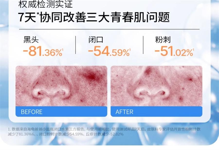 【中国直邮】 海龟爸爸 闭口水青少年控油抗痘爽肤水收缩毛孔精华水女孩湿敷水 150ml/瓶