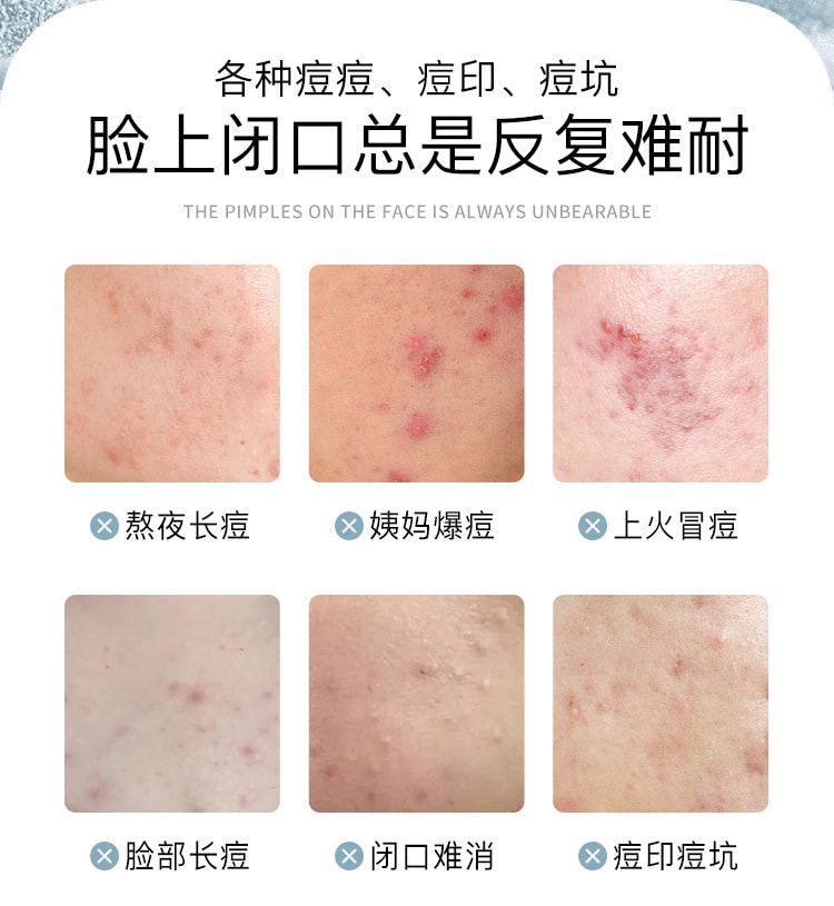 【中国直邮】 台湾 自白肌 丽颜肌 皮傲宁植物祛痘膏改善闭口痘坑痘印光滑嫩肤温和去痘草本 祛痘膏30g