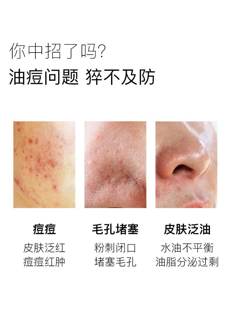 [中国直邮]BEDOOK比度克祛痘控油保湿补水面膜 8片