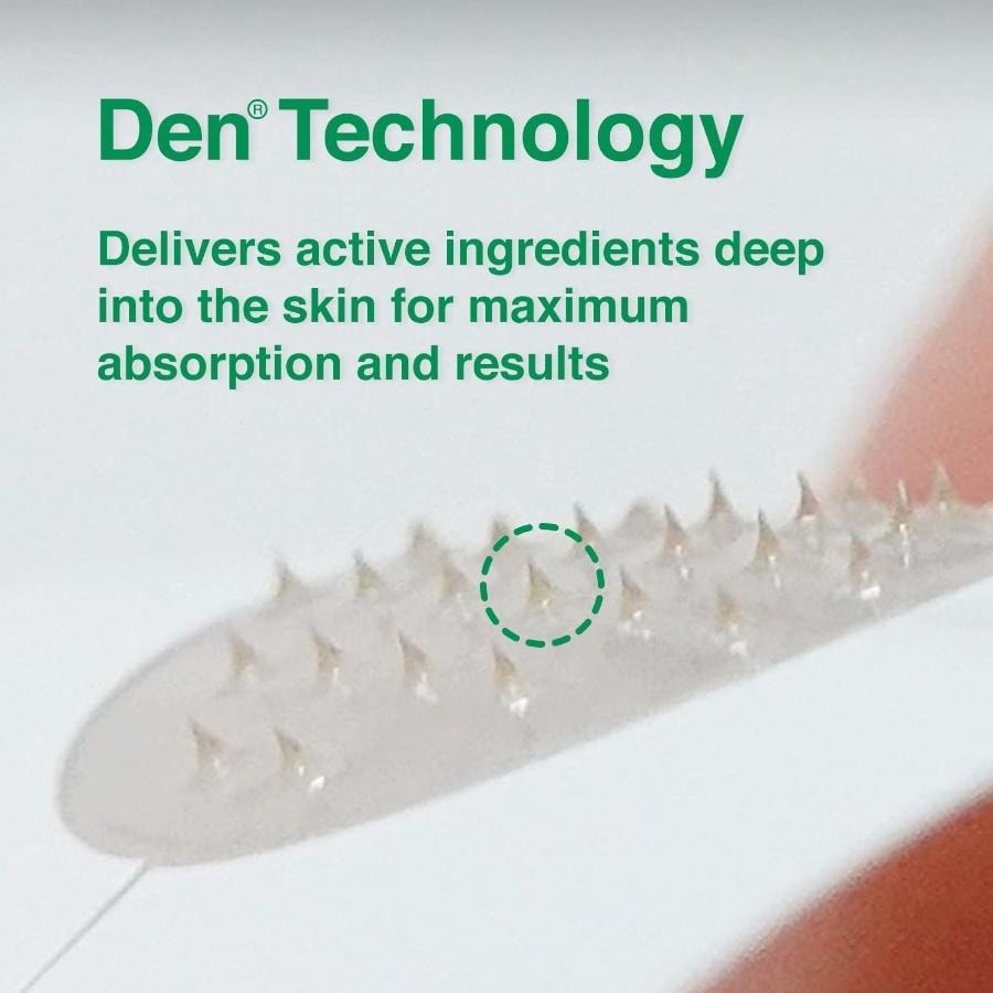 韓國 ACROPASS 微針粉刺修護貼 – 4片裝 淨膚護理