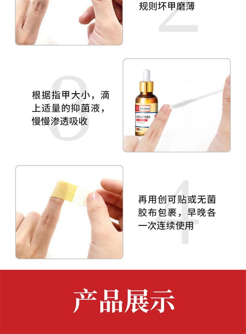 美國 南京同仁堂 灰指甲專用液體 甲溝炎藥水修腳剪刀冰醋酸抑菌液 30ml+小搓板+棉花棒+護理貼+增效膏