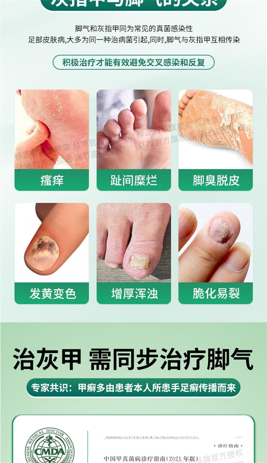 【中国直邮】 修正 环吡酮胺乳膏治脚气止痒脱皮杀菌专用药膏真菌感染水泡灰指甲  15g/支