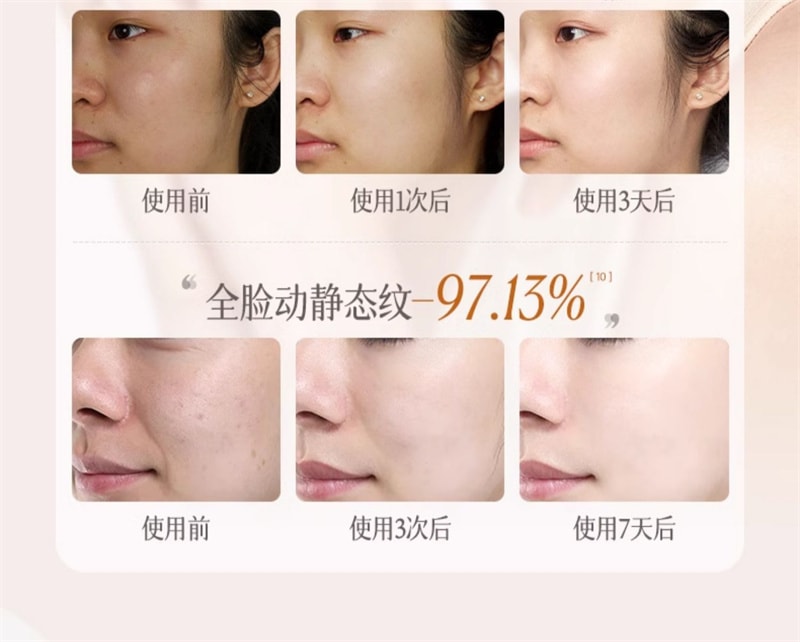 【中国直邮】 儒意 熊果苷爽肤水发光水 补水保湿去黄提亮收缩毛孔(A醇+虾青素500ml+VC+光果甘草500ml)