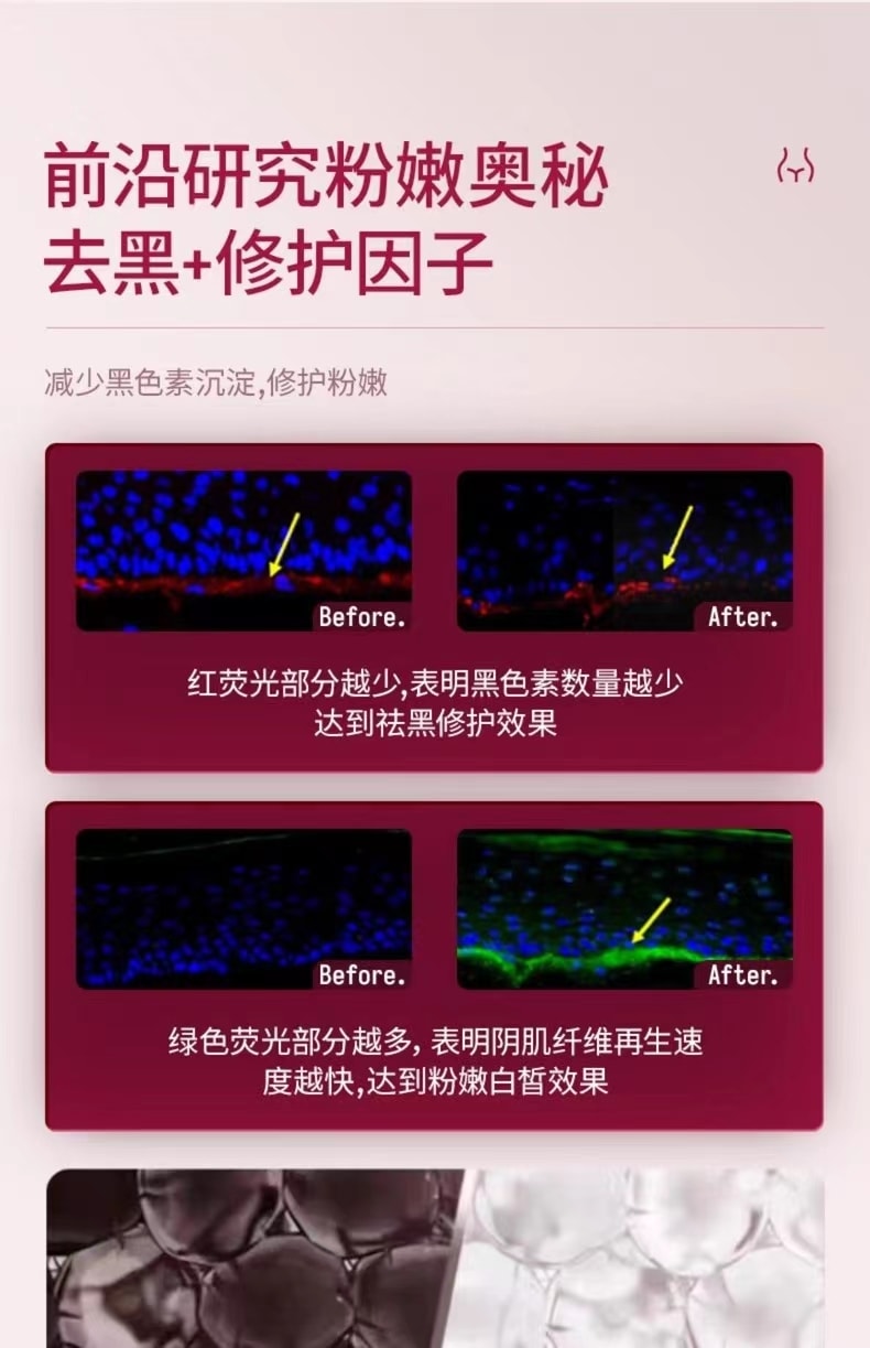 中國 TZK 婷資可私處護理凝膠粉嫩去黑色素嫩紅精華素 1件
