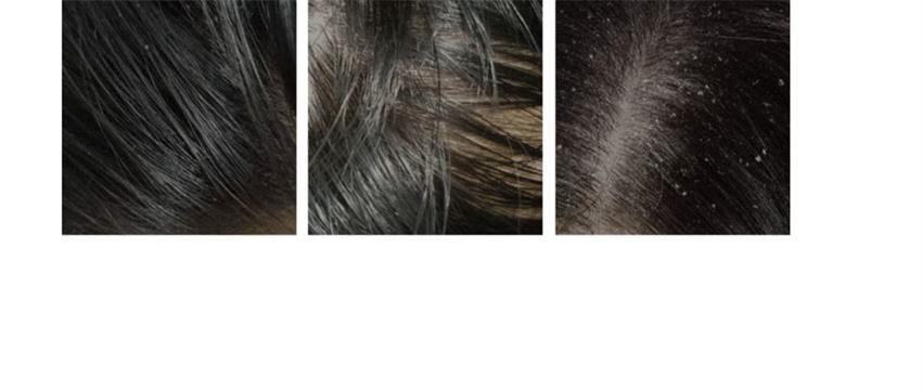 【中国直邮】 韩国 RNW 如薇 去屑蓬松洗发水 氨基酸轻盈柔顺顺滑改善毛躁 300ml/瓶