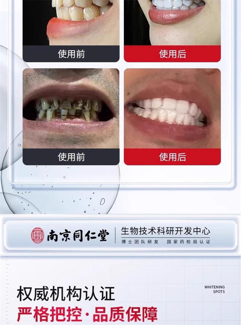 【中國直郵】 南京同仁堂 去黃牙膏煥白小蘇打去牙垢煙漬茶漬口氣清新男女通用 100g