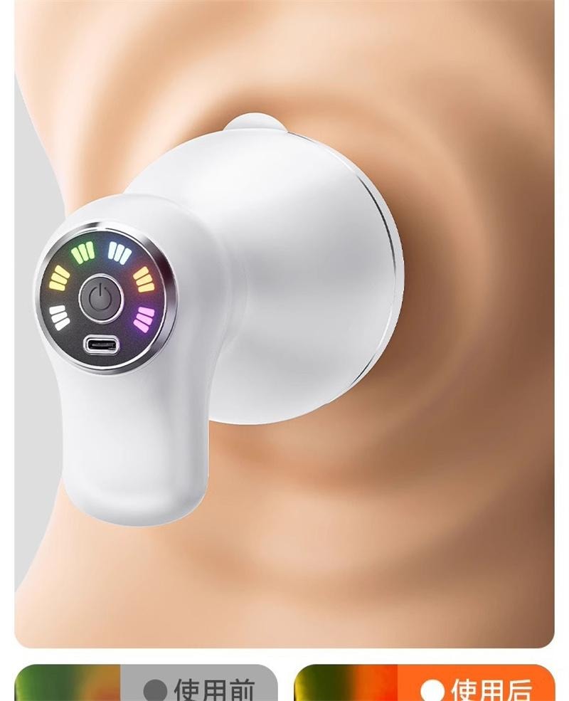 【中国直邮】 HYUNDAI 甩脂机抖抖机全身瘦肚子神器推脂器腰部赘肉燃脂震动 顶配款 1个装