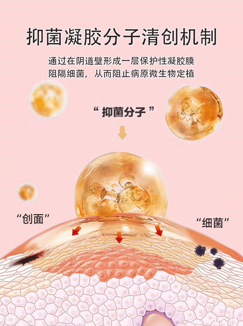  仁和 妇科凝胶抑菌正品私密处养护宫颈炎症霉菌性阴道炎  3g*5支/盒