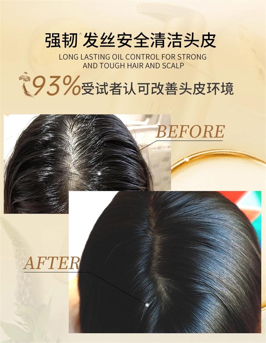 【中国直邮】 舒蕾 参姜洗发露 生姜防断发洗发水 固发强韧发丝温和清洁改善受损易断发质 355ml/瓶(胖东来爆款推荐)