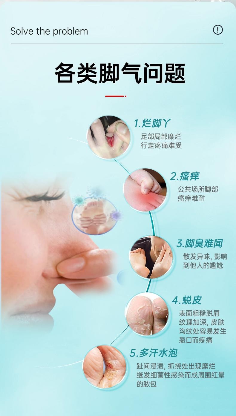 【中國直郵】 托噯 腳氣止癢脫皮殺菌噴霧去爛腳丫藥糜爛腳趾縫爛癢臭腳水泡膏灰指甲 30ml/瓶