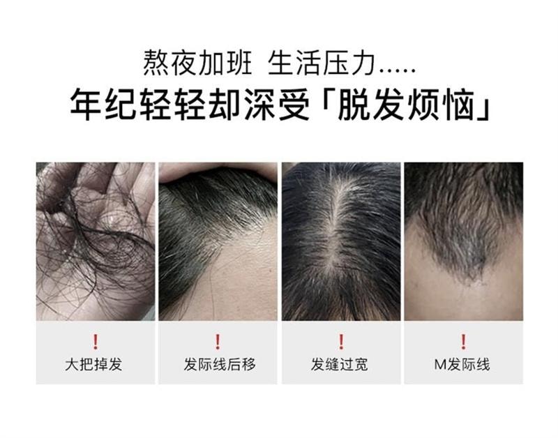 【中國直郵】韓國 RNW 如薇 固髮防脫洗髮水 柔順改善毛躁控油蓬鬆多效修護去油洗頭 300ml/瓶