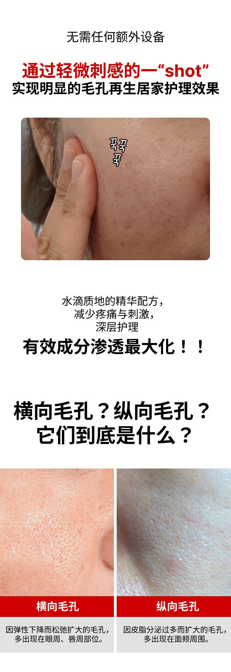 韩国 媂佩尔媂芙 药妆Differ&Deeper 微针毛孔再生精华 S-Cure 2只装