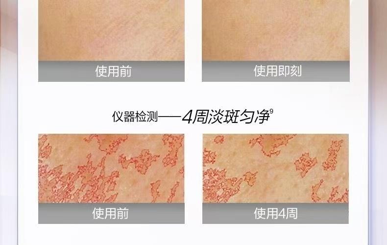 【中国直邮】 欧诗漫 珍珠美白淡斑精华面膜 补水保湿淡斑改善暗沉 1涂2敷两部曲 5片/盒