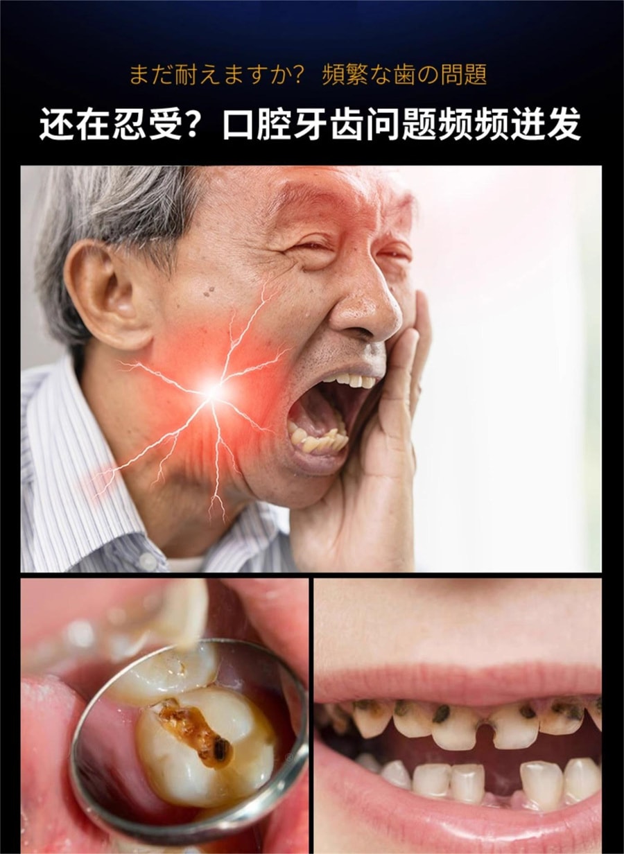 【中国直邮】正大 再生硅牙膏1支 牙周炎专用牙龈萎缩修复再生蛀牙牙洞清理龋齿非药