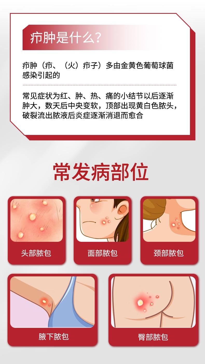 【中国直邮】 国药药材 鱼石脂抑菌软膏 适用于疖肿拔毒拔脓膏消肿止痛火疖子毛囊乳膏 20g/盒