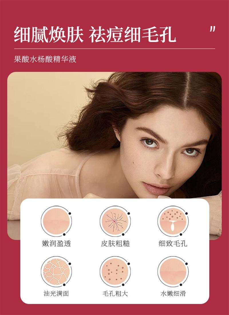 臻羞 果酸水楊酸收縮毛孔粗大修復護精華液刷面部酸淡化祛黑頭閉口粉刺 溫和剝脫老廢角質,疏通毛孔,改善閉口、粉刺、痘痘與粗糙膚質30ml