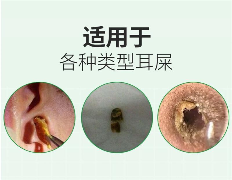 【中国直邮】 欧诺康 碳酸氢钠滴耳液软化耳屎采耳专用耵聍洗耳儿童耳清洁抑菌液 10ml/盒