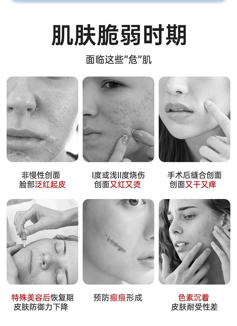 法兰度 医用重组三型人源化胶原蛋白凝胶15g 烧烫伤光子微整形创面