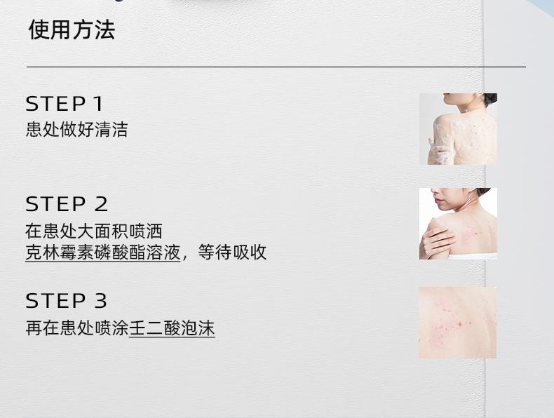 【中國直郵】 麗芙 克林黴素磷酸酯外用溶液 用於毛囊炎前胸後背祛痘噴霧背部祛痘除蟎 30ml/盒