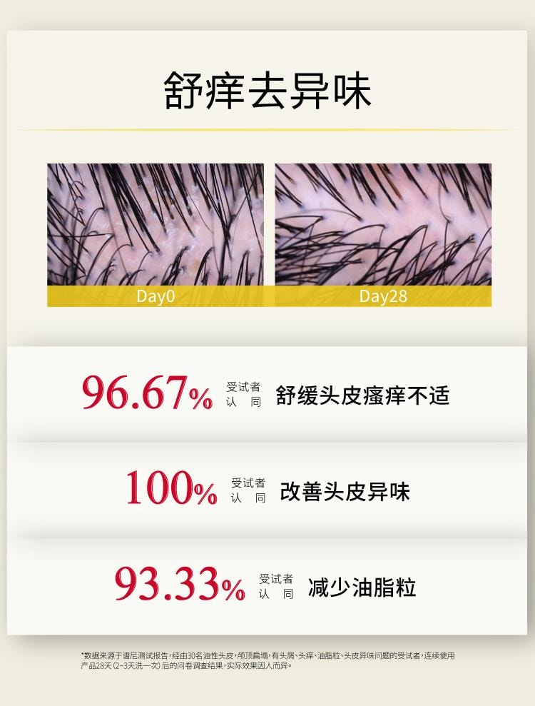 【中国直邮】 John Jeff 姜黄洗发水300g 蓬松头发 控油去屑 一次蓬松2~3天
