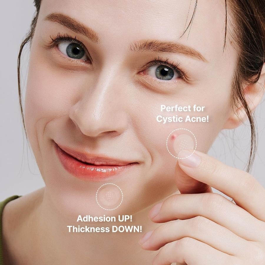 韓國 ACROPASS 微針粉刺修護貼 – 4片裝 淨膚護理