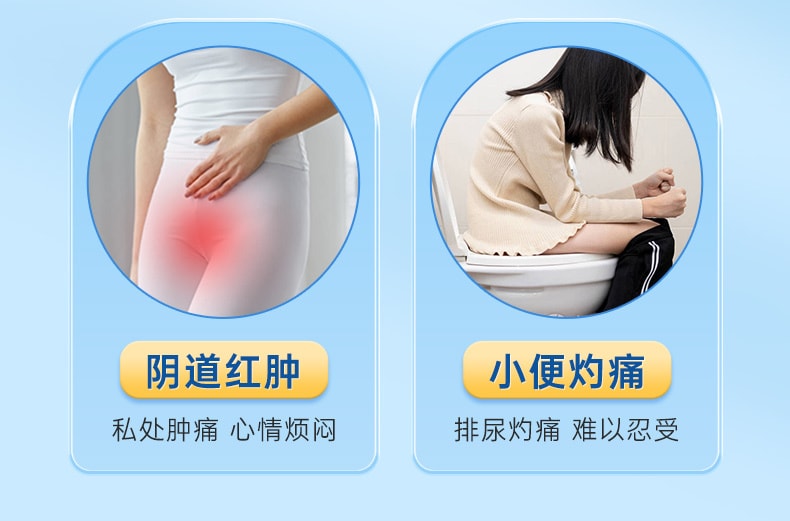 【中国直邮】 三益 克霉唑乳膏 正品妇科外阴瘙痒专用止痒阴道炎用药霉菌私处抑菌 30g/盒