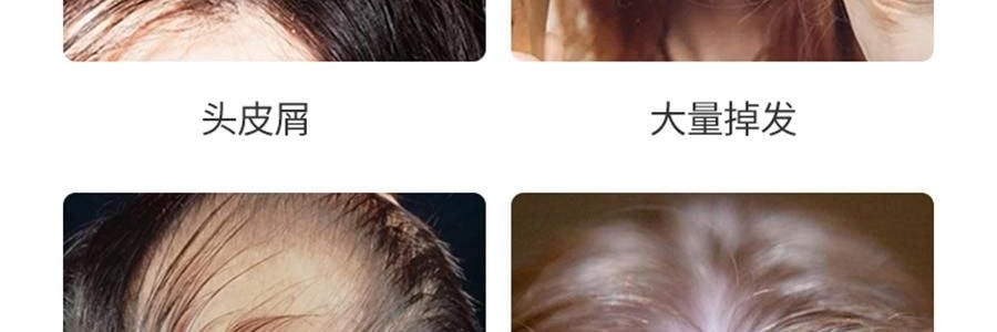 K·SKIN金稻 头皮按摩梳 防静电梳 负离子红光电动按摩梳子 护发防脱保健梳 KD3801 白色