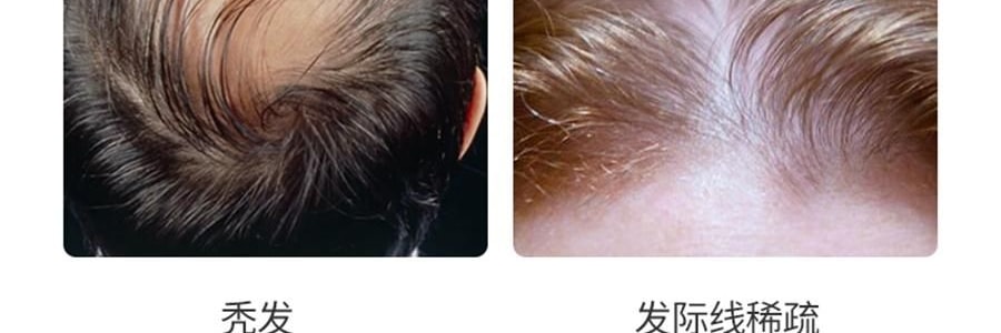 K·SKIN金稻 头皮按摩梳 防静电梳 负离子红光电动按摩梳子 护发防脱保健梳 KD3801 白色