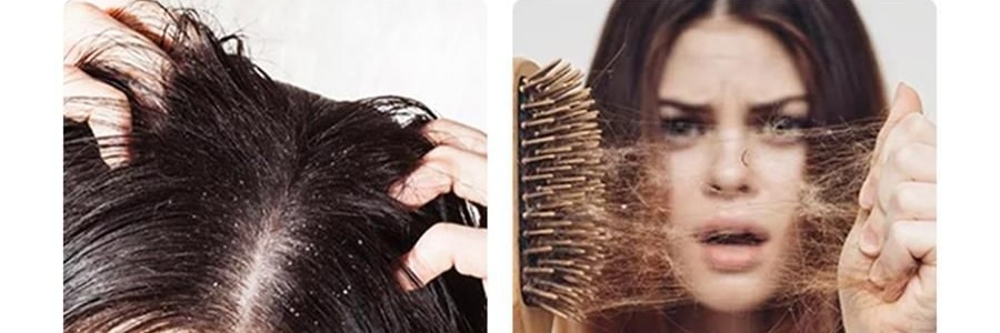 K·SKIN金稻 头皮按摩梳 防静电梳 负离子红光电动按摩梳子 护发防脱保健梳 KD3801 白色