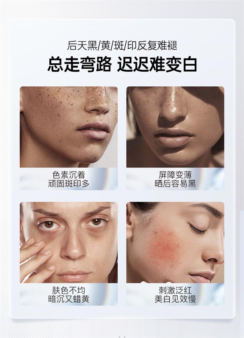 【中国直邮】 碧维斯 打斑美白丸全身美白淡纹祛斑谷胱甘肽葡萄籽褪黑丸40粒/盒