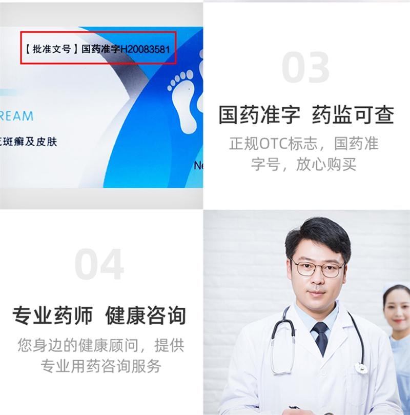 【中國直郵】 仁和 鹽酸特比萘芬乳膏 正品凝膠治療腳氣抗菌止癢殺菌腳癢腳裂藥膏 12g