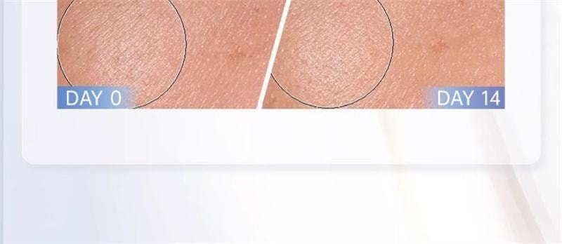 【中国直邮】 碧维斯 打斑美白丸 全身美白淡纹祛斑谷胱甘肽葡萄籽褪黑丸 40粒/盒